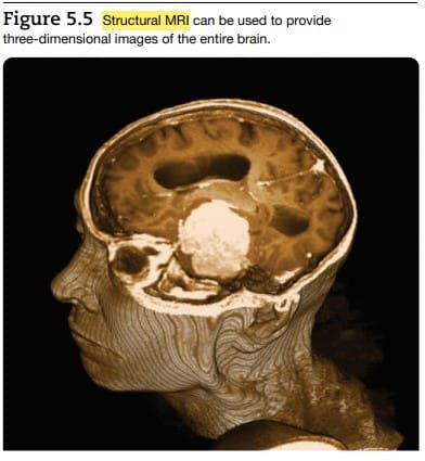3D MRI scan