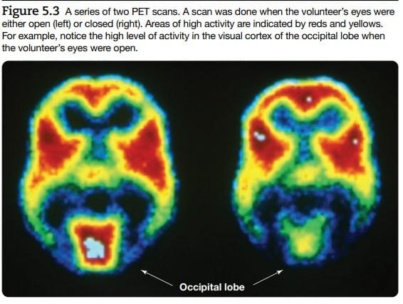 Research methods in neuropsychology : PET SCAN