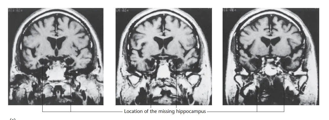 Brain Areas