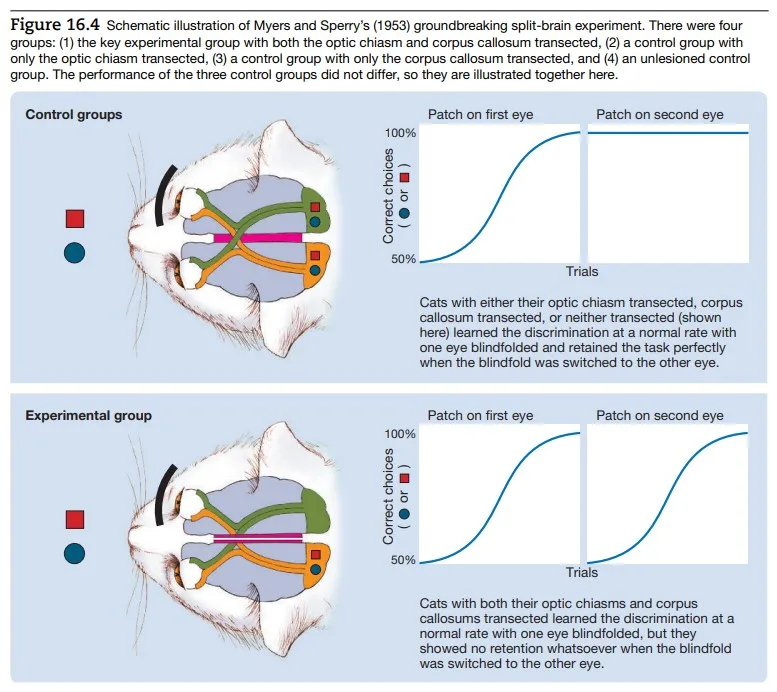 Split brain Experiment